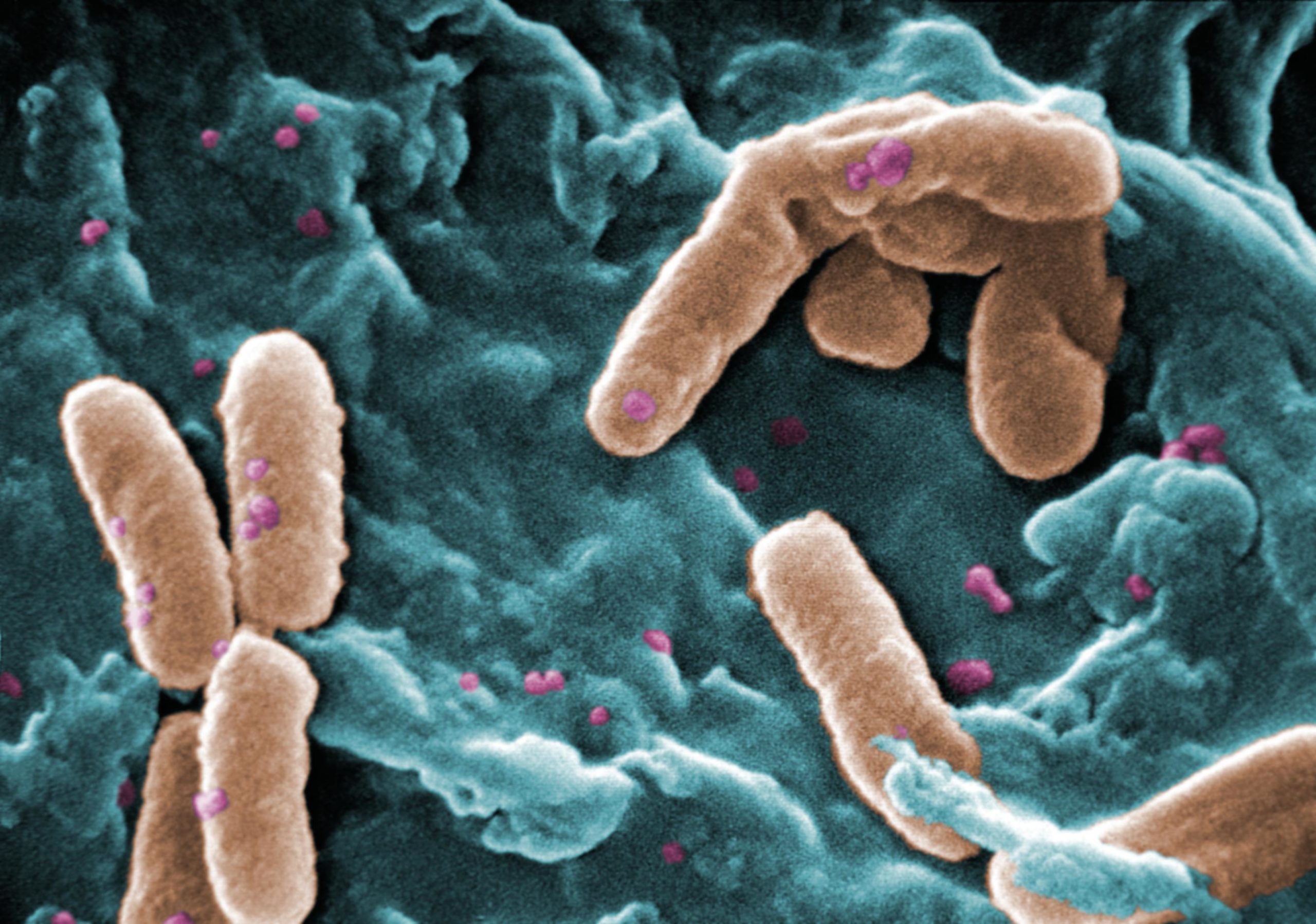 Image of Pseudomonas bacteria